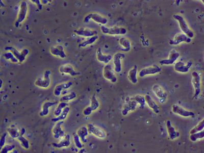 Florida man dies from brain eating amoeba after using tap water for sinus rinse