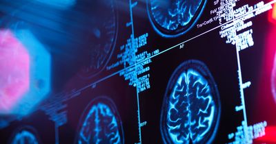 Person in US dies after becoming infected with rare brain-eating amoeba