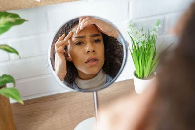 Struggling with adult acne? These are the common causes and treatments