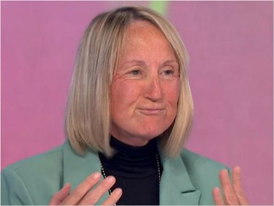 Loose Women’s Carol McGiffin addresses concern after face resembles ‘tomato’