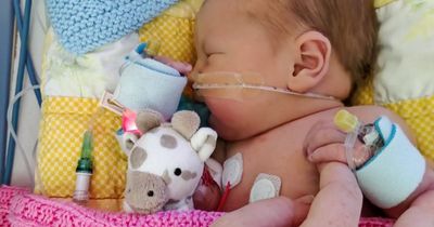 Miracle baby born with her heart wired the wrong way round survives major surgery