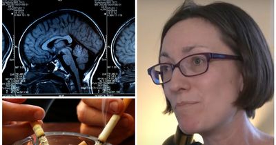 Newcastle consultant warns smoking kills brains cells and could see people in 40s and 50s get dementia later in life