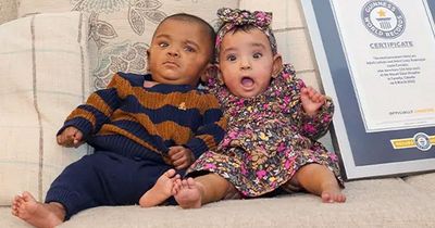 World's most premature twins celebrate first birthday - after overcoming 0% survival odds