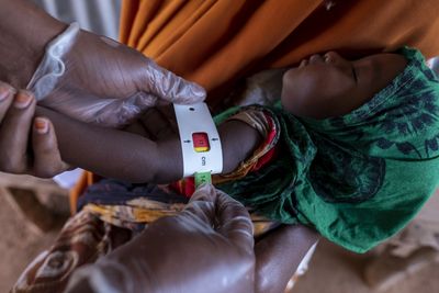 UN says malnutrition in mothers soars in crisis-hit countries