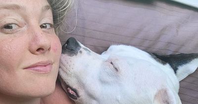 Woman's nose ripped off by boyfriend's pit bull after being 'scared by teeth whitening'