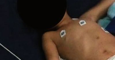 Boy, 6, has genitals cut off before being left for dead in ditch in sick attack