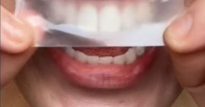 Primark shoppers brand £4 teeth whitening strips 'insane' as they work first time