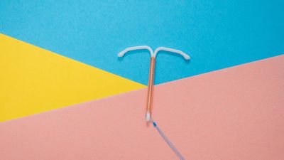 Calls for copper IUDs to be subsidised by the federal government