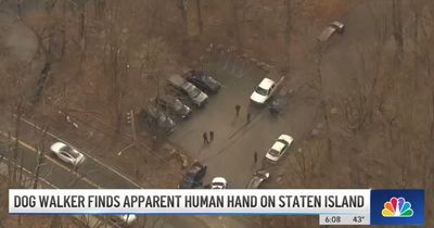 Dog discovers human hand while being taken out on a walk with owner