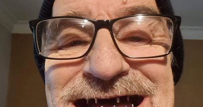 Grandad so self-conscious of rotting teeth he refused to smile transformed by Turkey trip