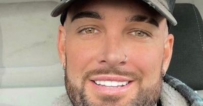'I'm a 'hatfish' - people mock my hairline but hair transplant gave me confidence'