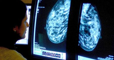 Research to prevent breast cancer ‘time bomb’ published