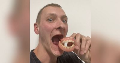 Toothless bachelor whose gnashers turned 'to mush' is on the quest for new smile