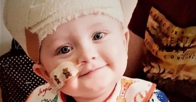 Worried mum dismissed by GPs 18 times discovers baby son has dangerous brain tumour