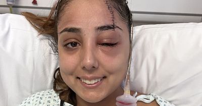 Teenager 'thought she'd die' after horror car crash left hair clip embedded in her scalp