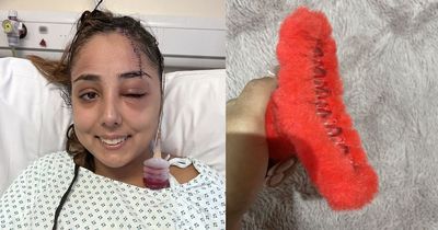 Student teacher almost killed in car crash as claw clip sliced her scalp