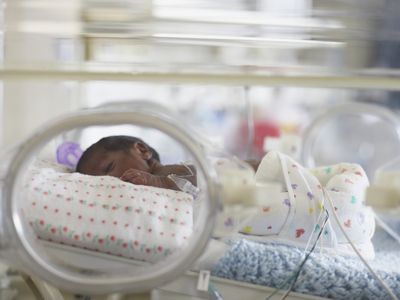 The U.S. has a high rate of preterm births, and abortion bans could make that worse