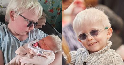 'People make rude and nasty comments about my three albino children'