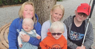 Mum pleads with strangers to stop 'nasty' remarks about her children with albinism