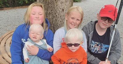Hebburn mum pleads with strangers to stop 'nasty' remarks about her children with albinism