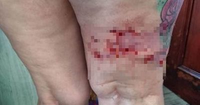 'A horrific dog attack left me traumatised - I can't leave my house while the dog is still out there'