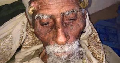 'World's oldest man' dies 'aged 140' after surgery to remove horn-like growths on head