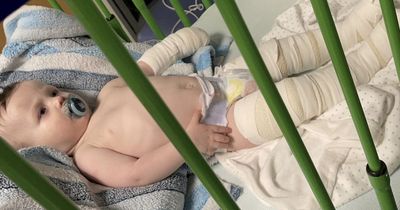 Baby burned with boiling bleach after using nursery cleaning bucket to pull himself up