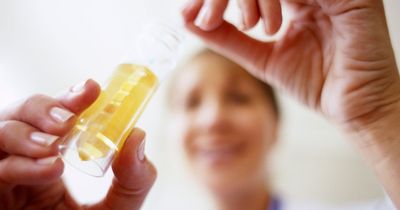 Bladder cancer symptoms as new urine test could detect disease 12 years before diagnosis