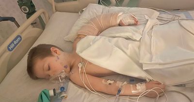 Boy, 3, nearly loses an arm after being viciously mauled by dog in his own home