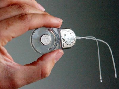 Review ordered into cochlear implant issues for SA kids