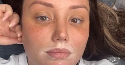 Charlotte Crosby thrilled with permanent make-up results after getting fillers dissolved