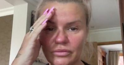 Kerry Katona tells of agony after walking round on broken foot without realising