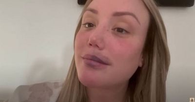 Charlotte Crosby feeling 'instantly better' after new permanent make-up procedure