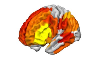 Psychedelic brew ayahuasca’s profound impact revealed in brain scans
