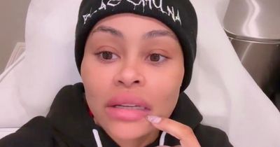 Blac Chyna warns fans over fillers saying she looked 'crazy' with 'layers' of injectables