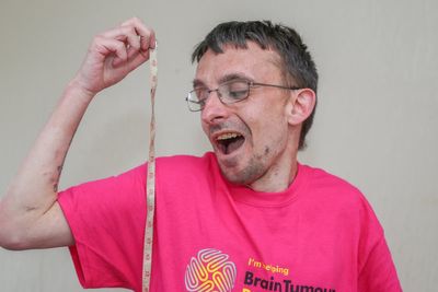Man who thought he was short for his age finds out brain tumour to blame for height