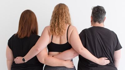 Lipoedema, the painful condition you've probably never heard of