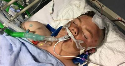 Scottish mum opens up on horror quad bike crash that left teen son in a coma