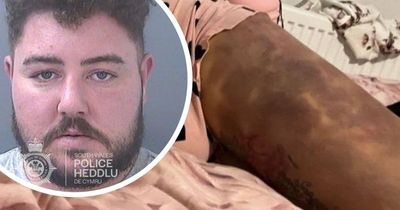 'A 23-stone man stomped, punched and choked me... I'm terrified if he is let out of prison he will find me'