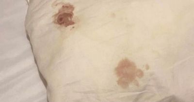 Scots mum left Blackpool hotel after finding 'bug' and urine stains on mattress