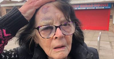 Gran-of-six bruised and battered after being 'knocked over' by boy on e-scooter