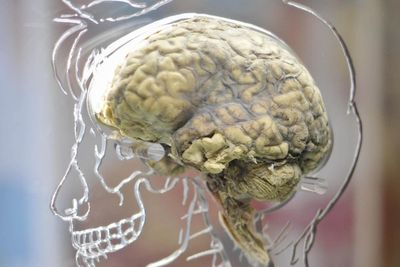 Study reveals how face transplant patient recognises new appearance as their own