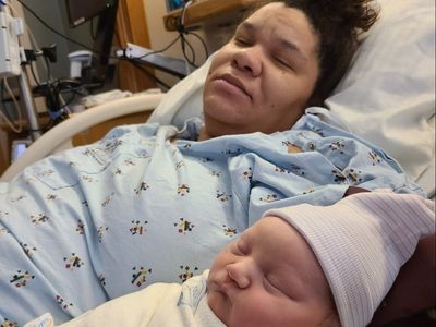 ‘Two different people’: Woman goes viral after getting extreme ‘pregnancy nose’ and people can’t recognise her face