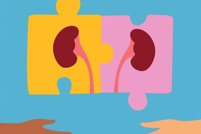 Donating kidney does not affect life expectancy