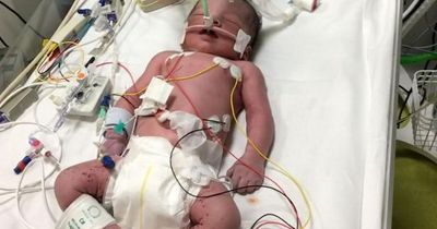 Mum sues hospital after pregnancy advice left her son severely disabled