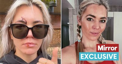 A Place In The Sun's Danni Menzies feared she wouldn't work again after horror crash