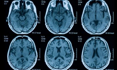 Myths about brain damage recovery