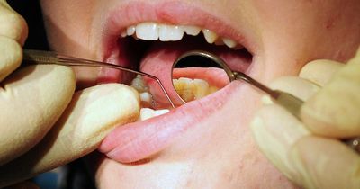 How much you will pay as NHS dentists see price hike in April