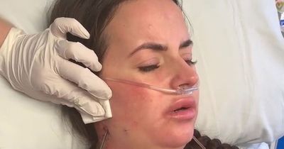 'My new face scared my son, and phone didn't recognise me after surgery'