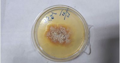 Man's hoarse voice was caused by plant fungus disease which left him unable to swallow
